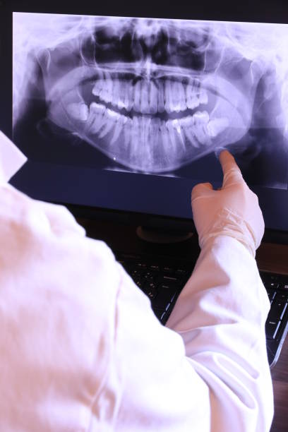 Best Emergency Wisdom Teeth Removal in Rancho Cumonga, CA